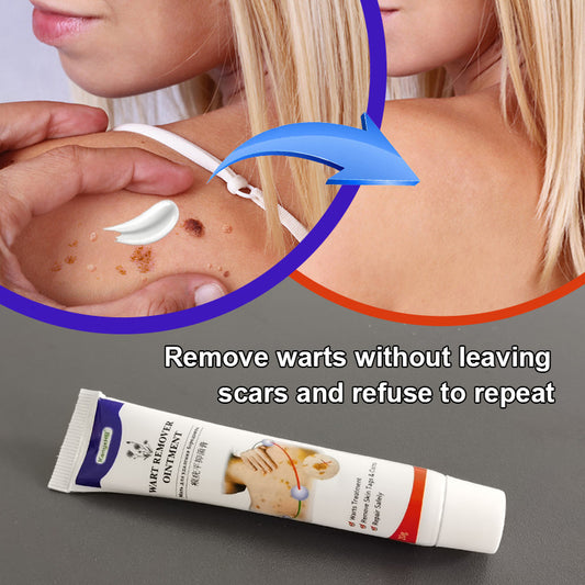 Wart Remover Cream Flat Monkey Yo Wart Removal Cream